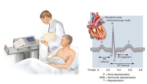 Electrocardiografía para detectar enfermedades cardiovasculares con hipertensión