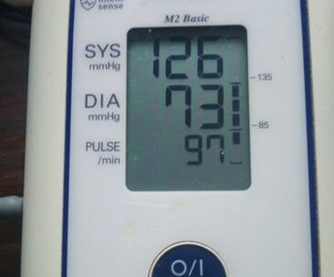 medición después de la recepción MiCardium